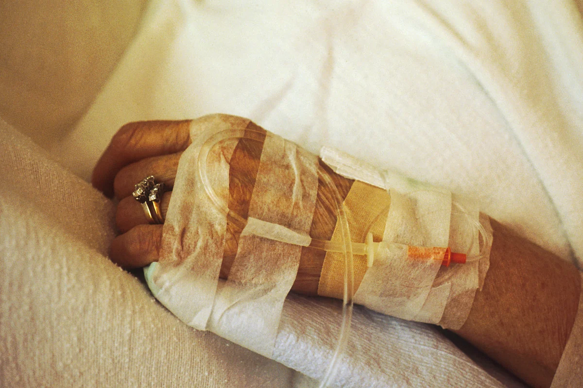 Dettaglio di una mano con un accesso venoso per la somministrazione di chemioterapia